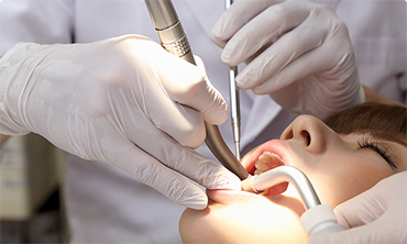 虫歯の治療・予防
